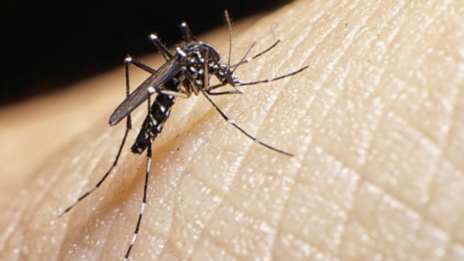 Nicaragua registraría primer caso de microcefalia por zika