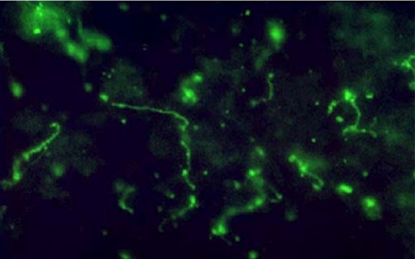 Minsa reporta fallecimiento por leptospirosis