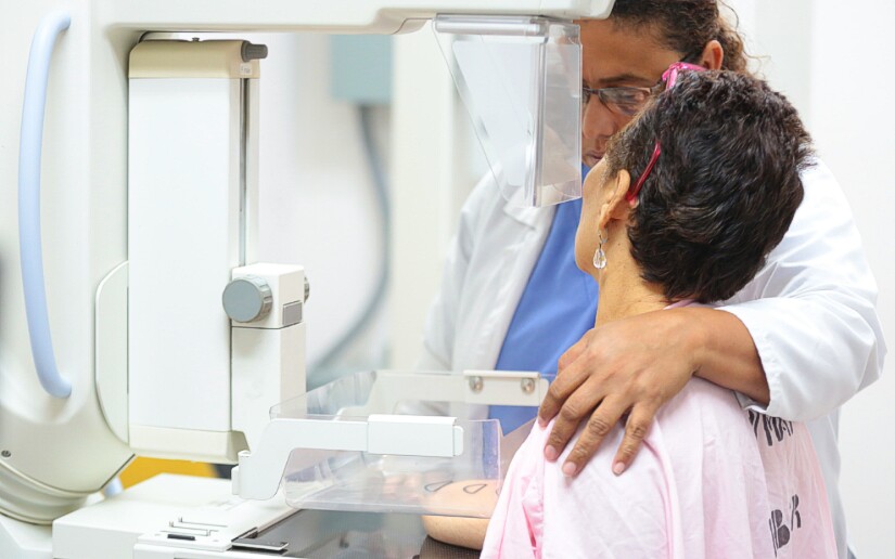 Hospital Bertha Calderón realiza amplia jornada de mamografías