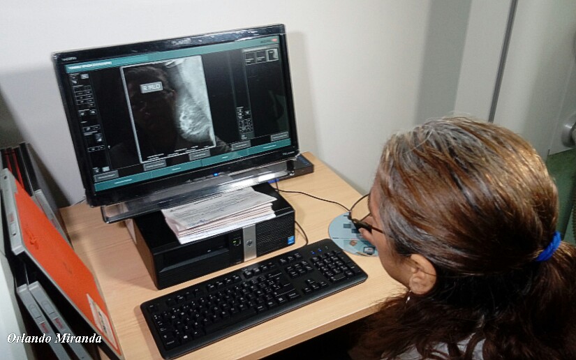 Hospital Bertha Calderón realiza jornada gratuita de mamografía