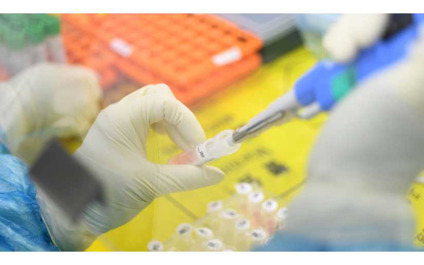 Vacuna contra el coronavirus podría estar lista en 18 meses
