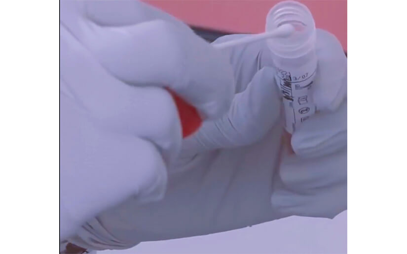¿Cómo detecta Nicaragua los casos de Coronavirus?