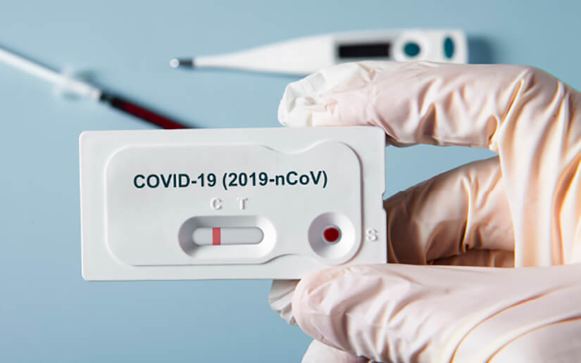 Gobierno de Nicaragua agradece importante donación de pruebas rápidas de Covid-19 