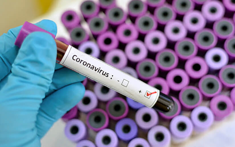 Nicaragua: Situación del coronavirus al 21 de abril