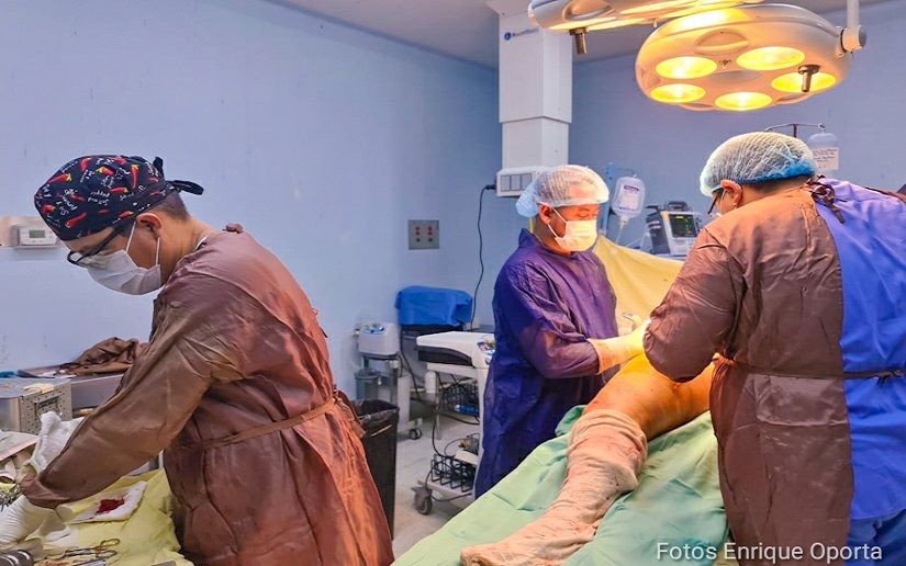 Realizan exitosa jornada de reemplazo de cadera y rodillas en el Hospital Manolo Morales en Managua
