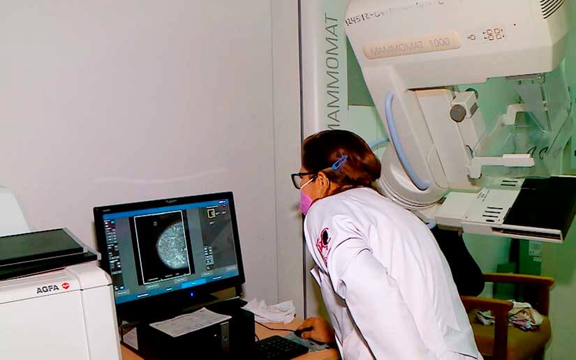 Realizan jornada de mamografías en hospital Bertha Calderón