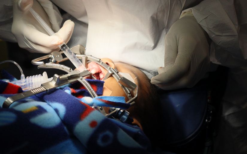 Devuelven sonrisa a niños y niñas en jornada quirúrgica del Hospital Vélez Paiz