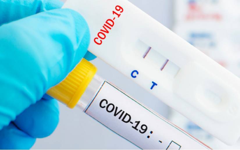 Ministerio de Salud reporta 3 casos positivos de Coronavirus durante la última semana 