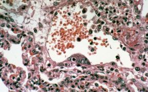 Rebrota un virus mortal que no tiene cura y deja sus primeras víctimas