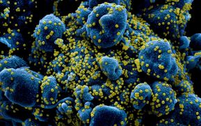 (+FOTOS) Así ataca el coronavirus a las células humanas