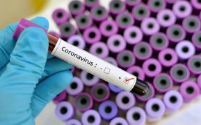 Nicaragua reporta 3 casos confirmados de coronavirus hasta este momento