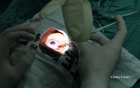 ¿Cómo se garantiza la salud visual en Nicaragua?