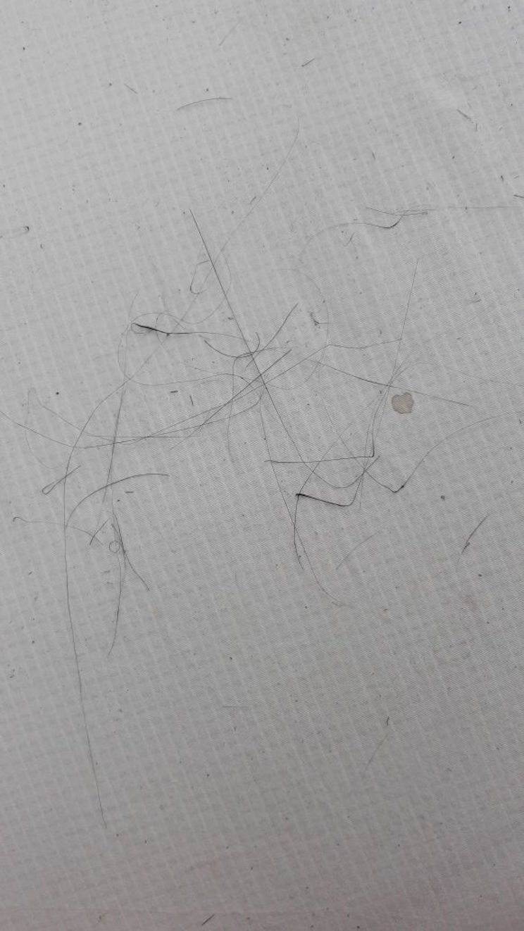 Cabello de Pelé