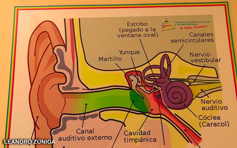 AUDICION