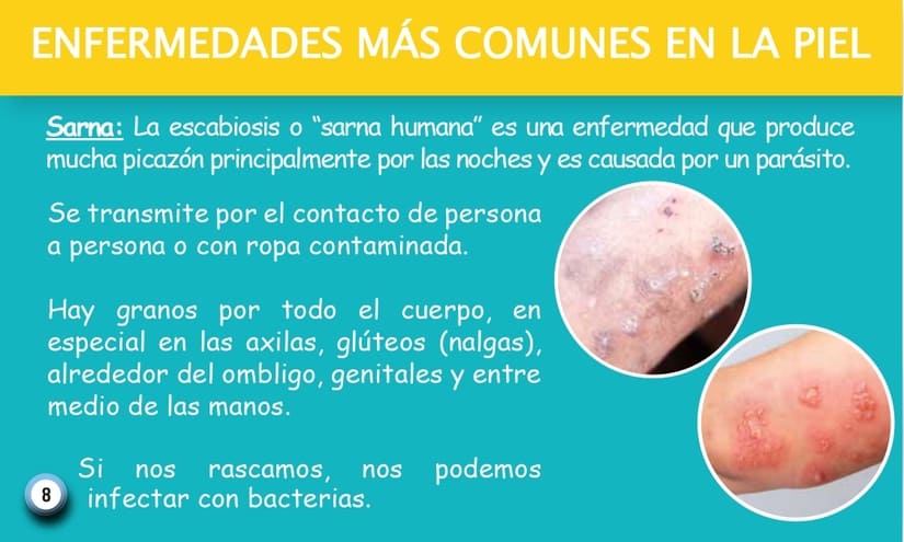 PIEL