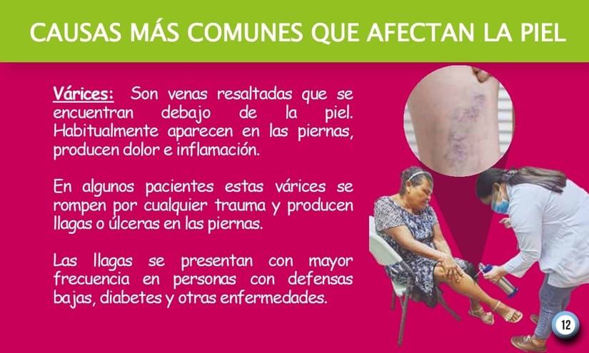 PIEL